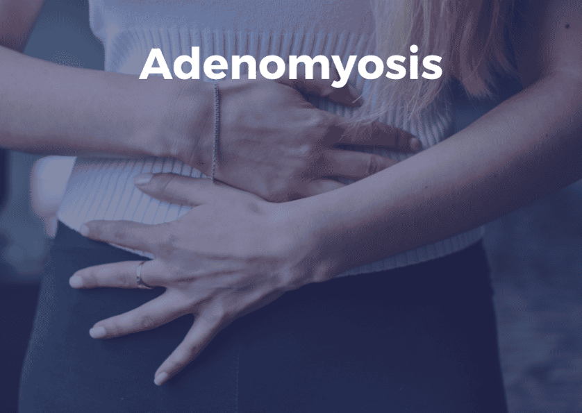 Adenomyosis