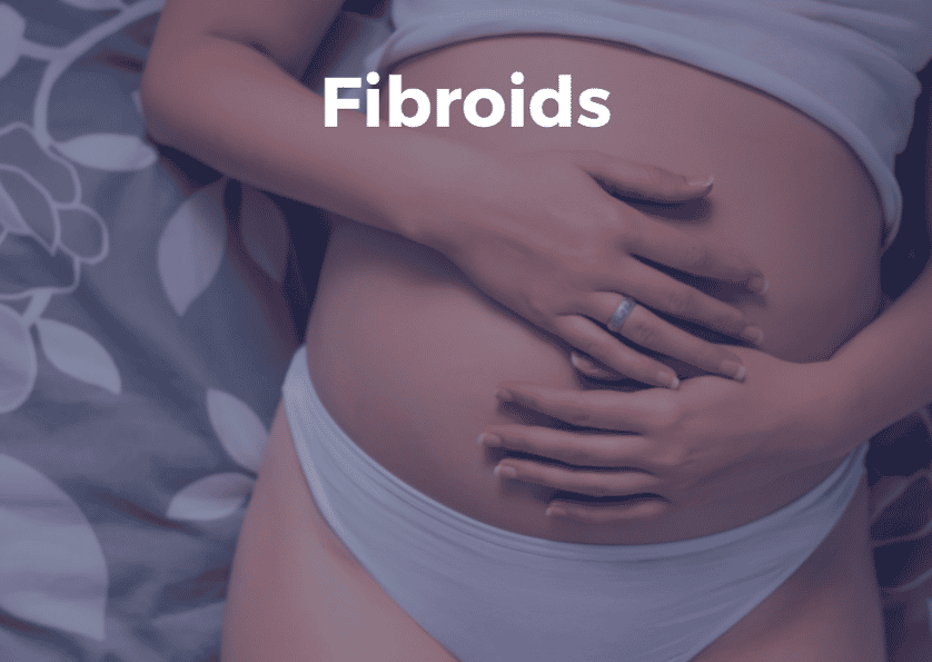 Fibroids