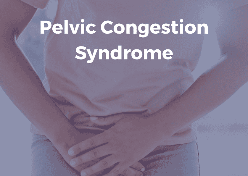 Pelvic congestion syndrome